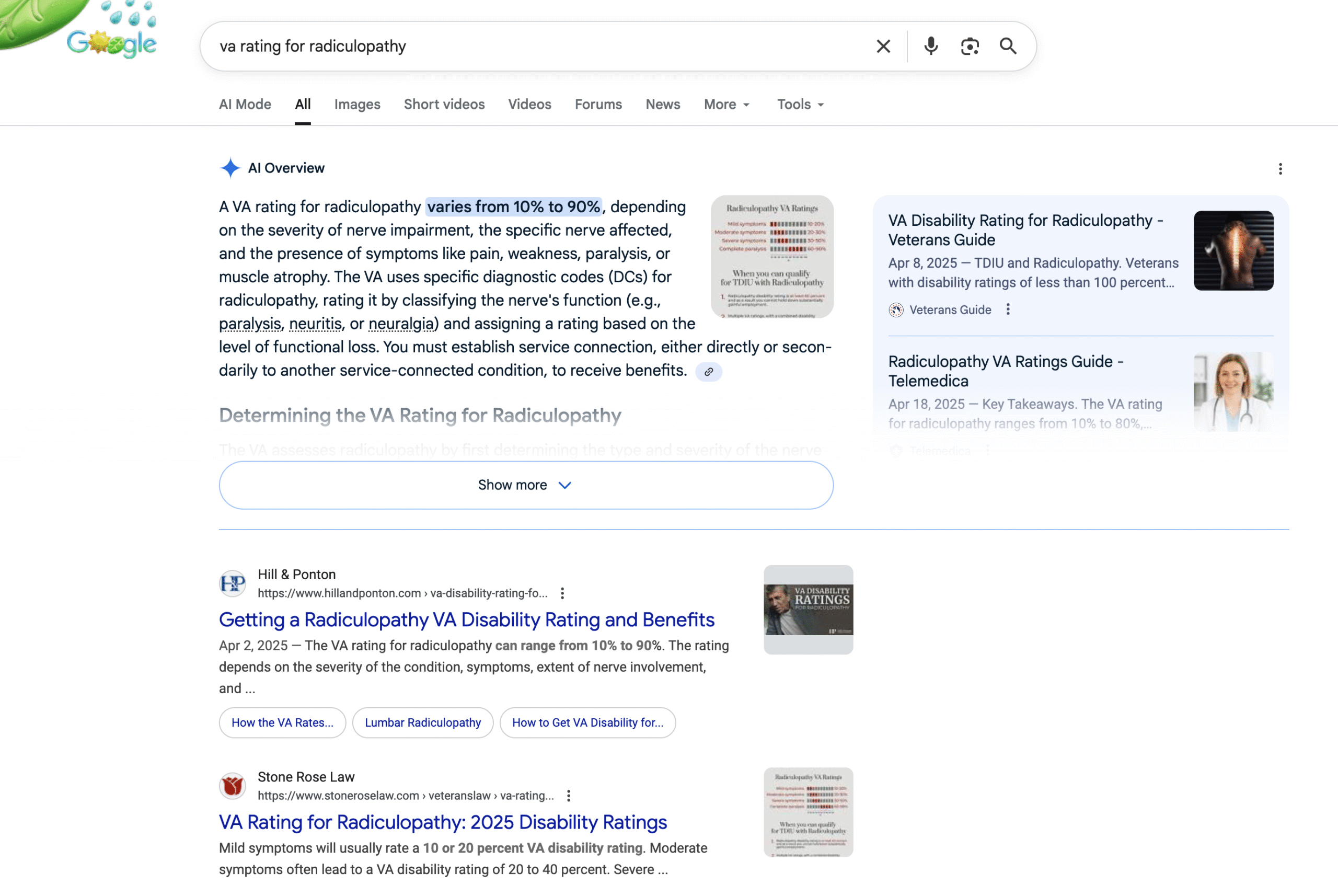 Stone Rose Law VA Rating for Radiculopathy